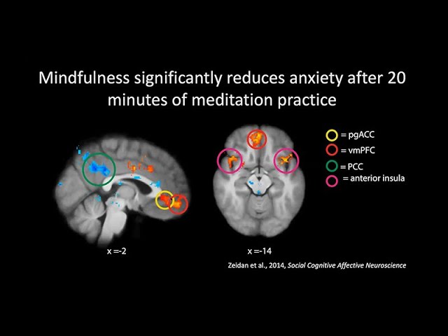 Mindfulness and Compassion - How They Work Together