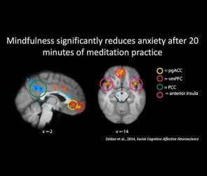 The Science Behind Mindfulness and Brain Health